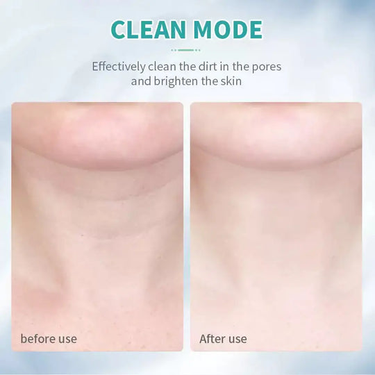Isabel Pro Gesichtsmassagegerät™ - Anti-Falten- und Facelift-Gesichts- und Nackenmassagegerät